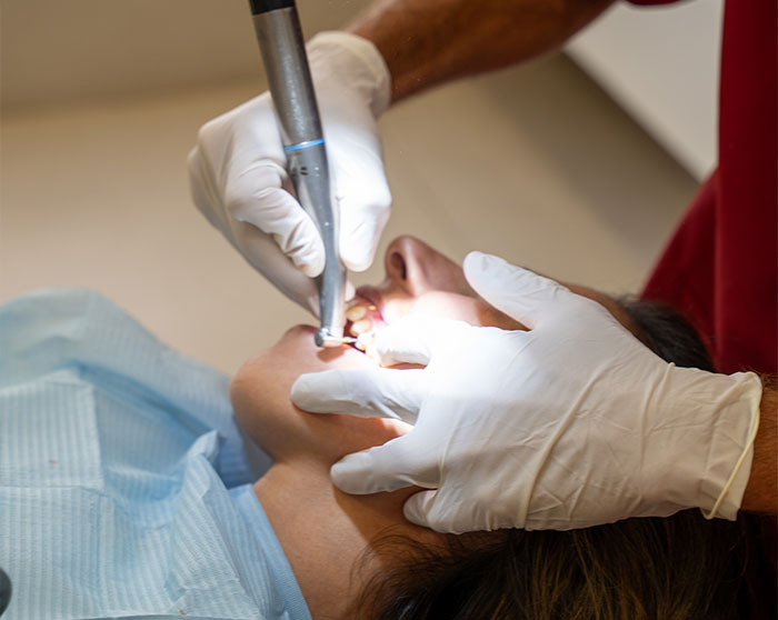 Baragado-dental-recontorneado estetico