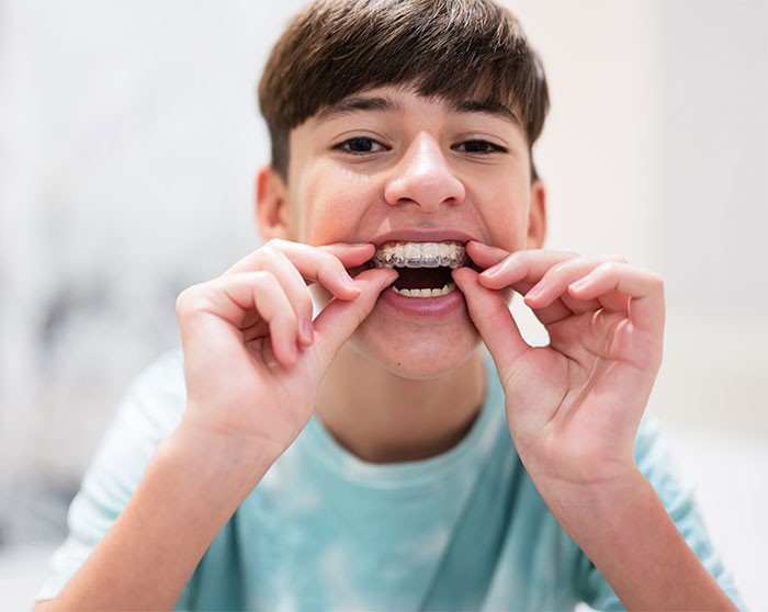 Baragado-invisalign-first-niños