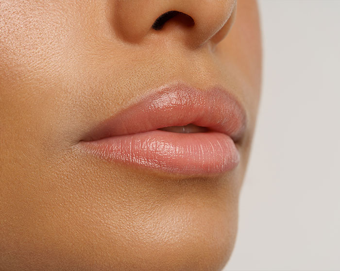 Bragado-acido-hialuronico-labios
