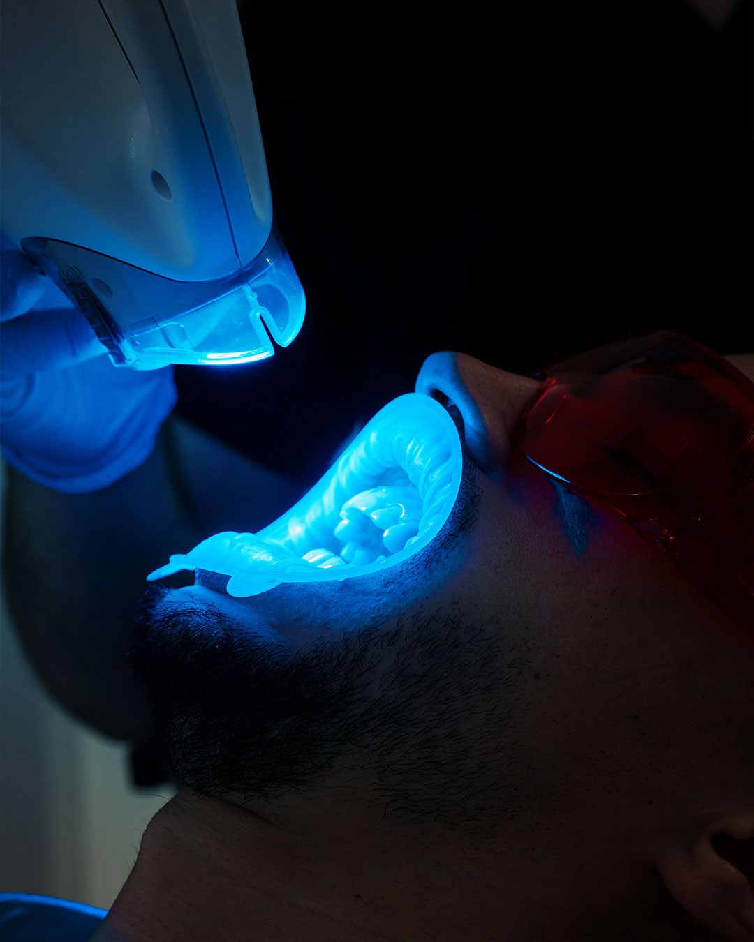 Bragado-dental-blanqueamiento LED