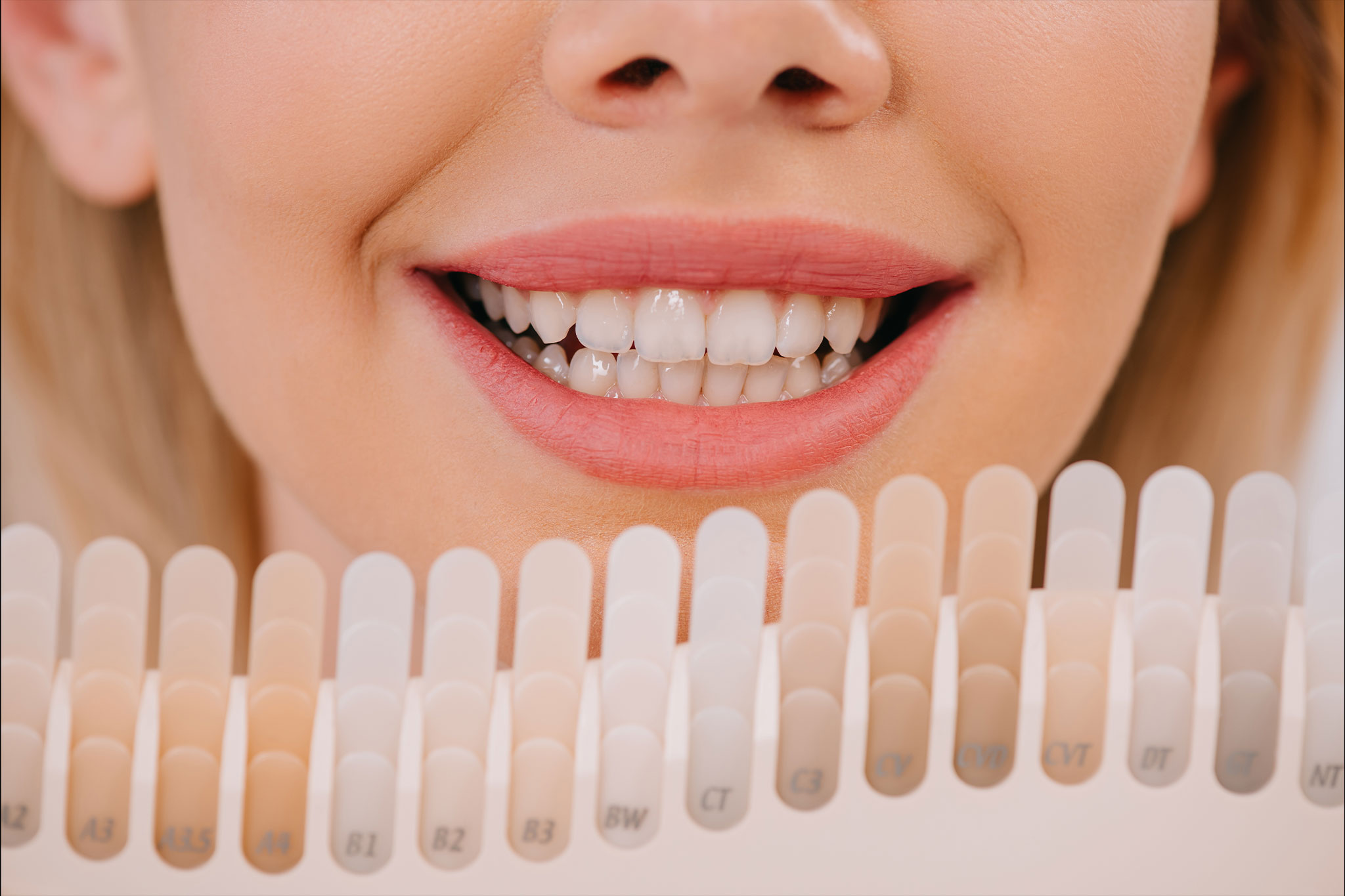 Bragado-dental-blanqueamiento