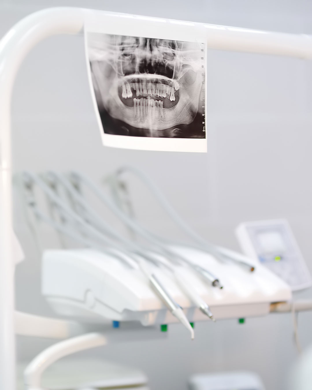 Bragado-dental-cadiz-endodoncia