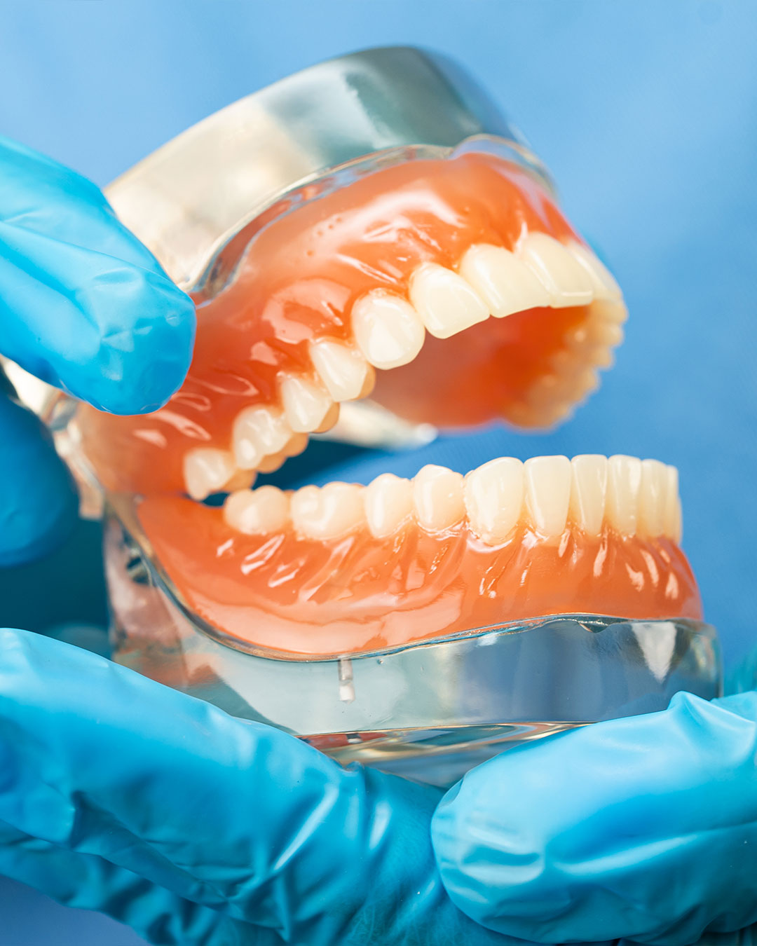 Bragado-dental-cadiz-protesis