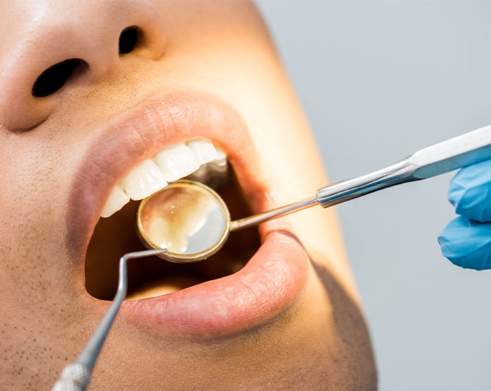 Bragado-endodoncia-reendodoncia