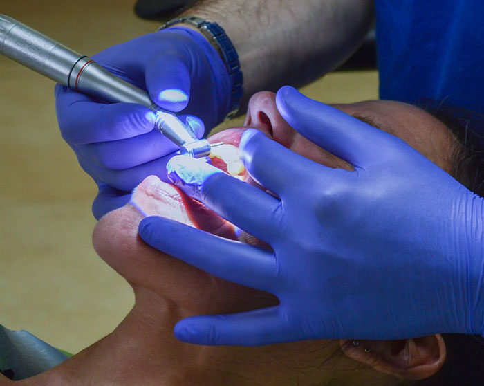 Bragado-odontologia-general-limpieza