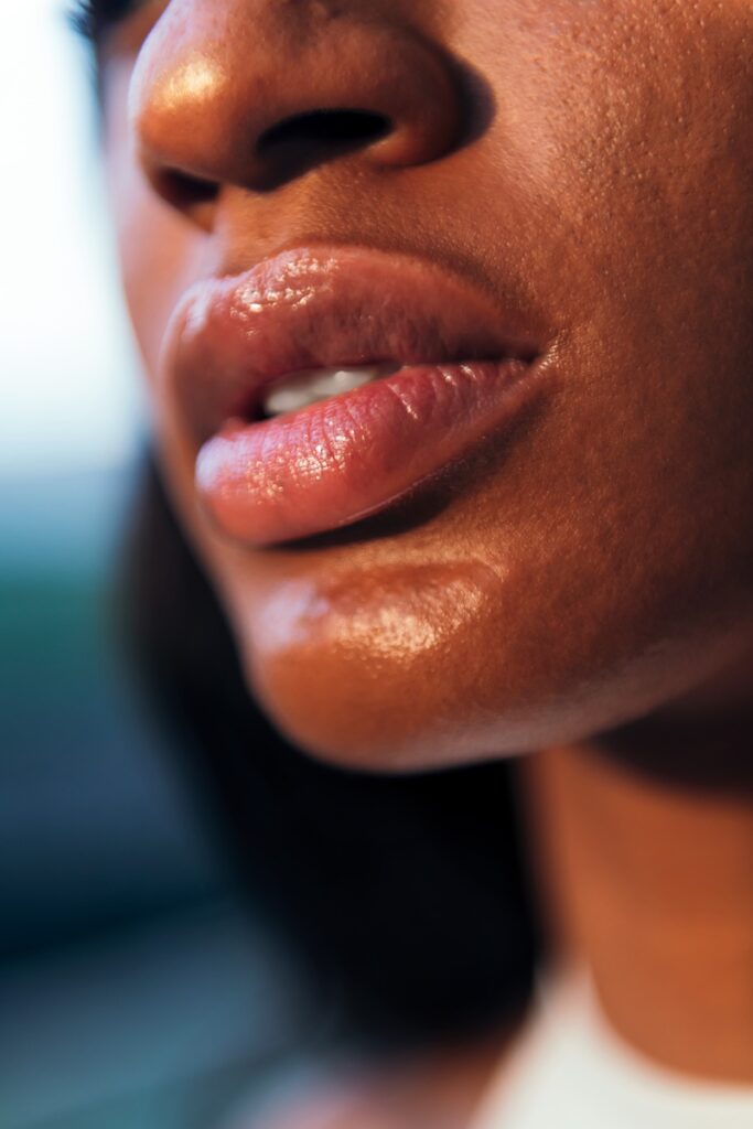 Mujer labios bonitos con Ácido Hialurónico en Bragado Dental